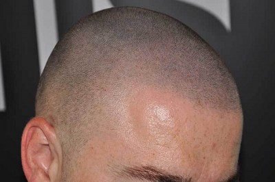 Hair
