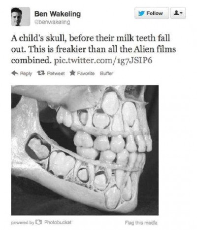 Child's Skull Before Milk Teeth Fall Out