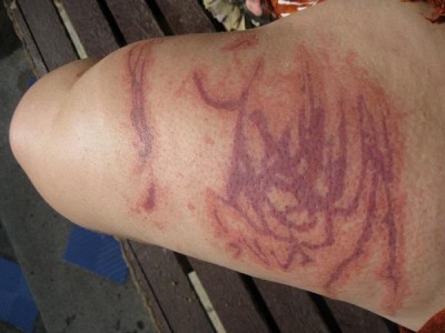 Box jellyfish