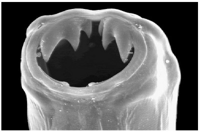 Hookworms