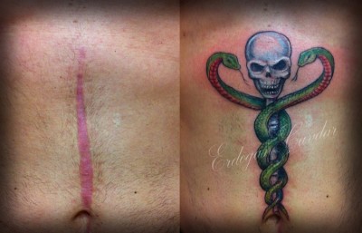 Best tattoos to cover a scar