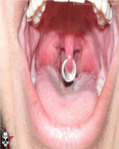 Uvula