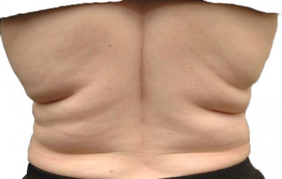 Sore Back