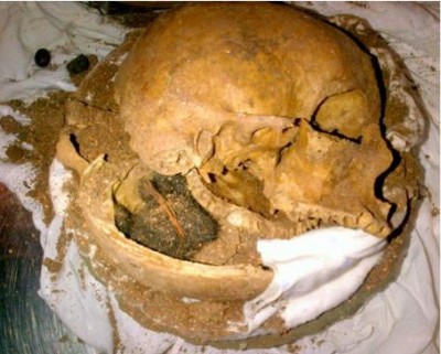 Human Skull