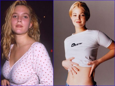 Drew Barrymore Before And After Breast Reduction Surgery