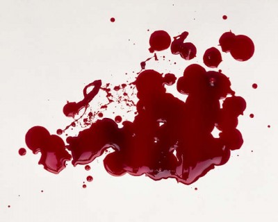 Abnormal bleeding