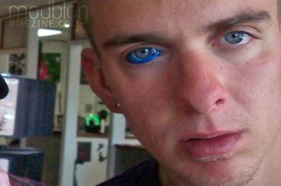 Eyeballs