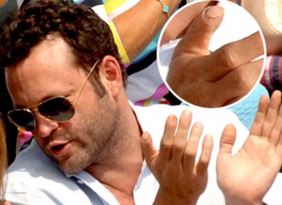 Vince Vaughn - Cut Thumb Tip