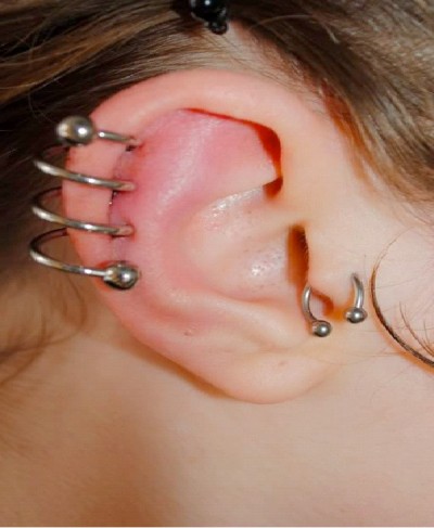 Helix Piercing