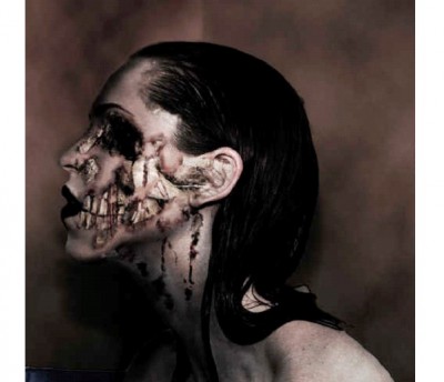 Cotard's Syndrome