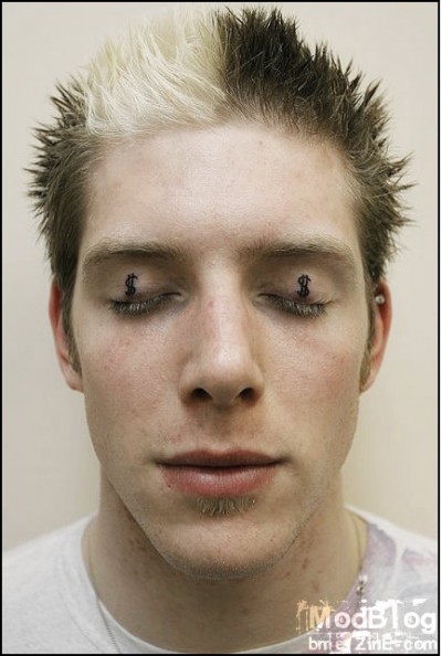 Eyelids