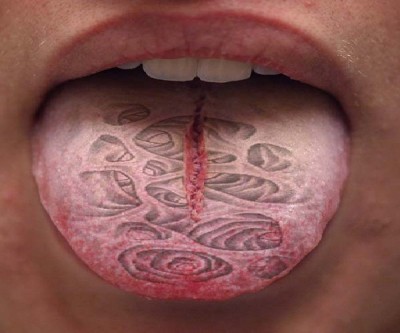 Tongue