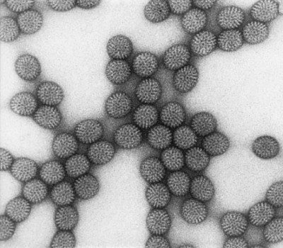 Rotavirus