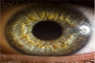 The iris
