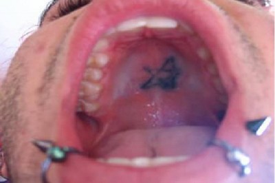 Palate