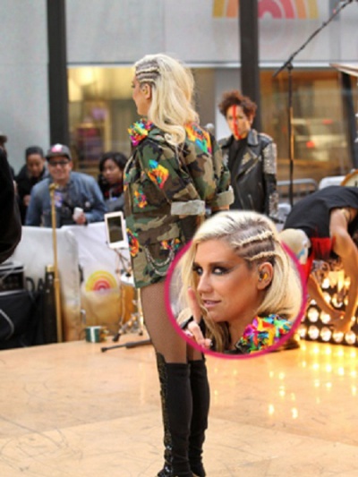 Kesha's vestigial tail