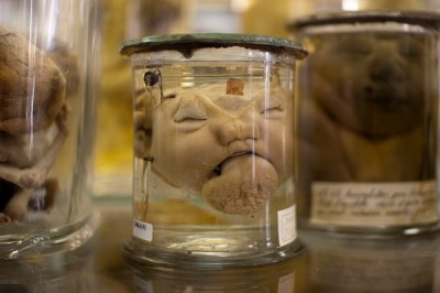 Musee Dupuytren