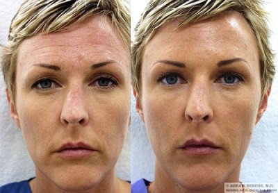 Botox can be learnt in a weekend.