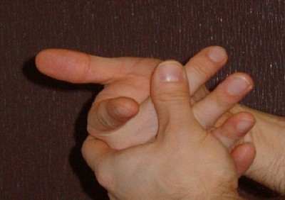 Cracking Knuckles Gives You Arthritis
