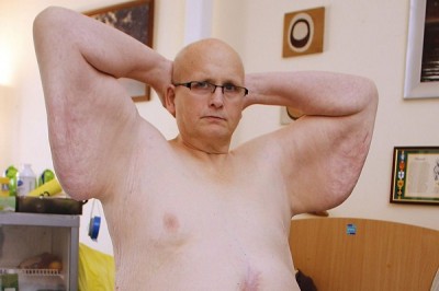 Arms