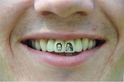 Your teeth