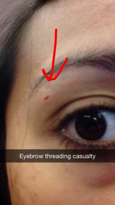 Eyebrow Threading Accident