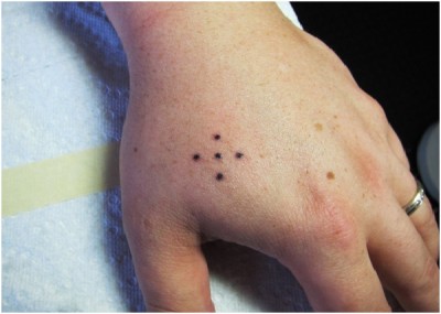 Five Dots Tattoo