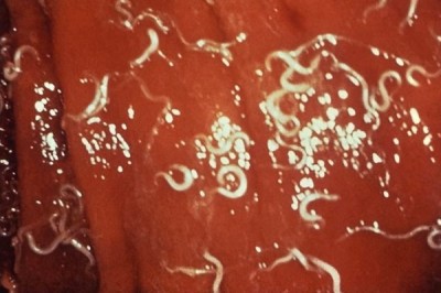 Parasitic worms