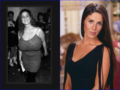 Soleil Moon Frye Before And After Breast Reduction Surgery