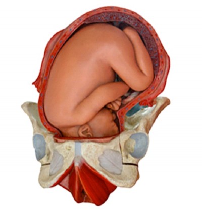 Uterus Grows to 5 Times It's Size