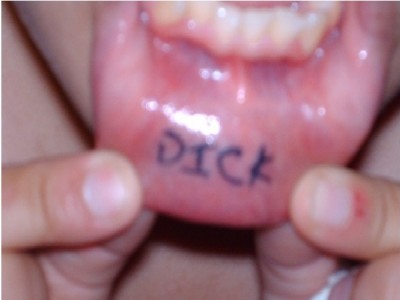 Dick