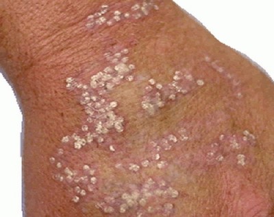 White spots