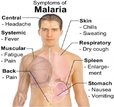 Malaria