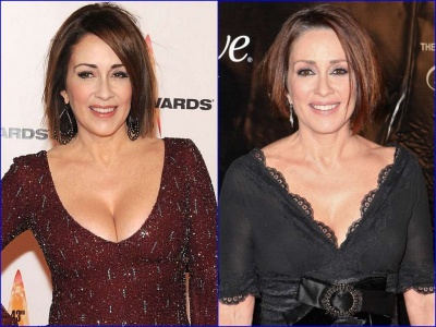 Patricia Heaton Before And After Breast Reduction Surgery