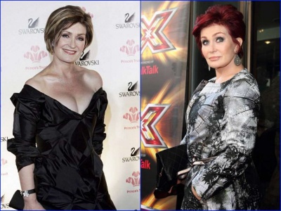 Sharon Osbourne Before and after Breast Reduction Surgery