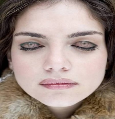 Eyelids