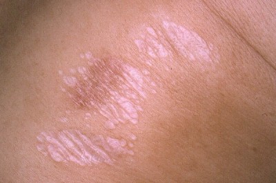 Unexplained marks