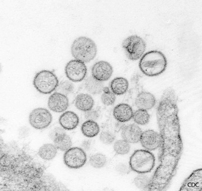 Hantavirus