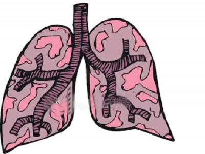 Tuberculosis