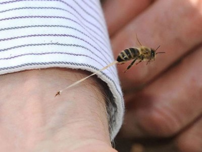 How Honey bee stings