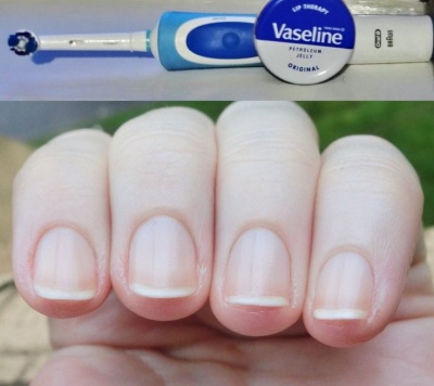 Follow This Hack To Protect Your Cuticles And Skin Around The Nail