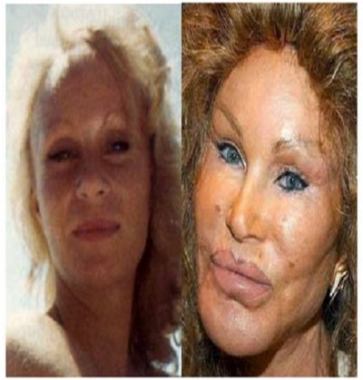 Jocelyn Wildenstein (Before & After)