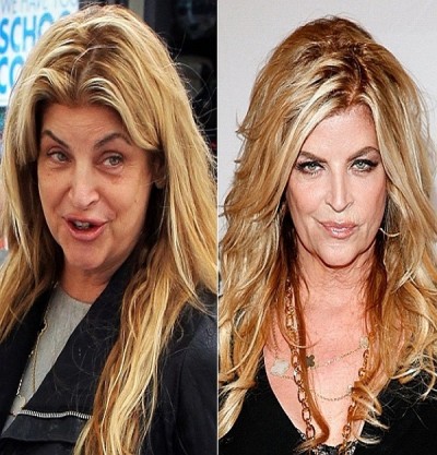 Kirstie Alley