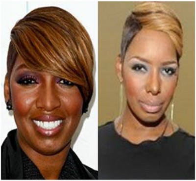 NeNe Leakes (Before & After)