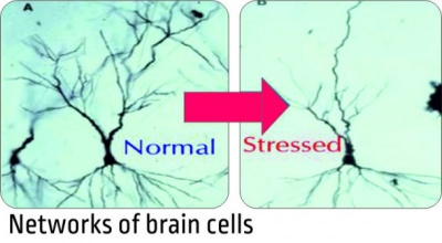 Stress Shrinks The Size Of Brain