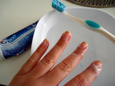 Whiten Your Nails Instantly After Removing A Dark Nail Polish