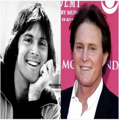 Bruce Jenner (Before & After)