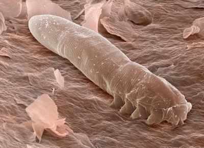 Your Skin and Eyelashes Are Home For Mites  