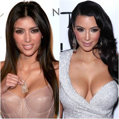 Kim Kardashian (Before & After)