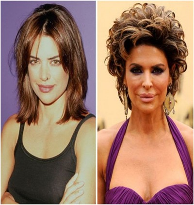 Lisa Rinna (Before & After)